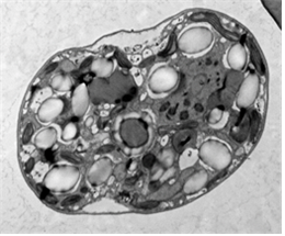 에프레니움 보라튬(Effrenium voratum) 투과전자현미경 사진 (사진=해양수산부)